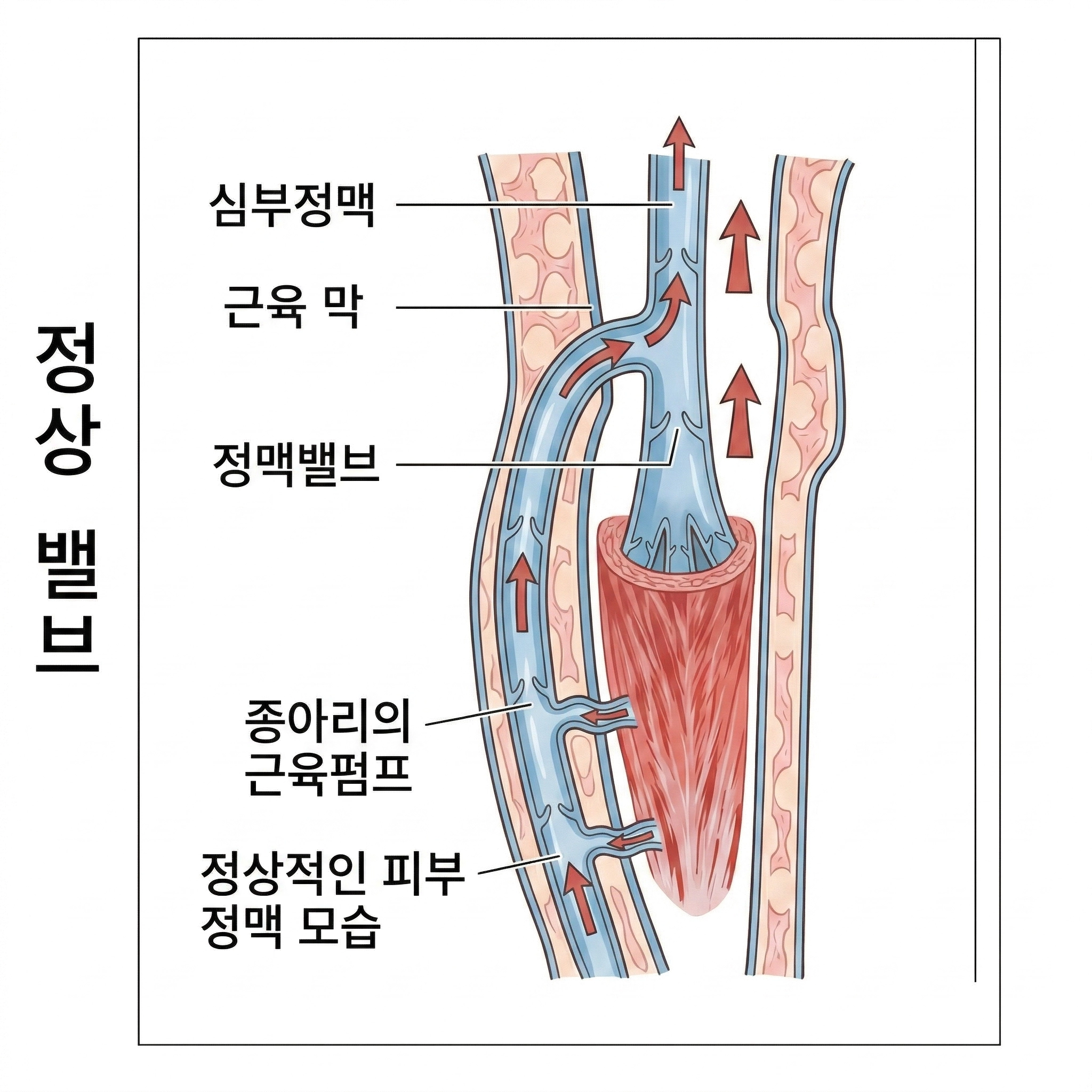 벨브가 닫혔을때